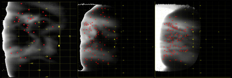 Detalhes do lado noturno de Vénus, observado no infravermelho, onde são visíveis marcadores da posição de aspetos específicos das nuvens. 